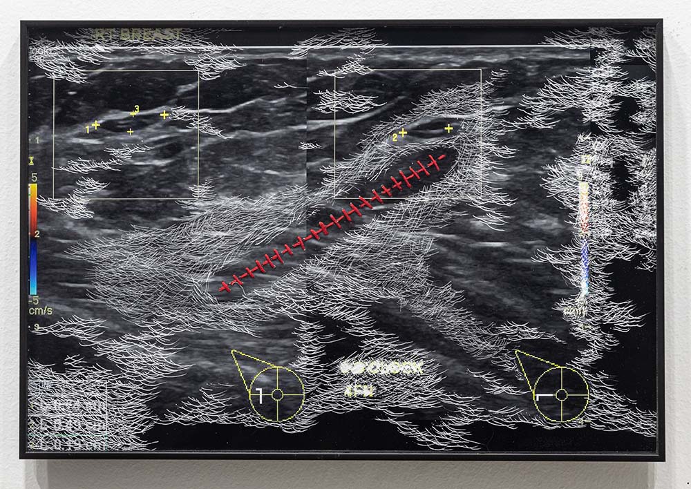 Incursions, Incisions and Transgressions  , 2023